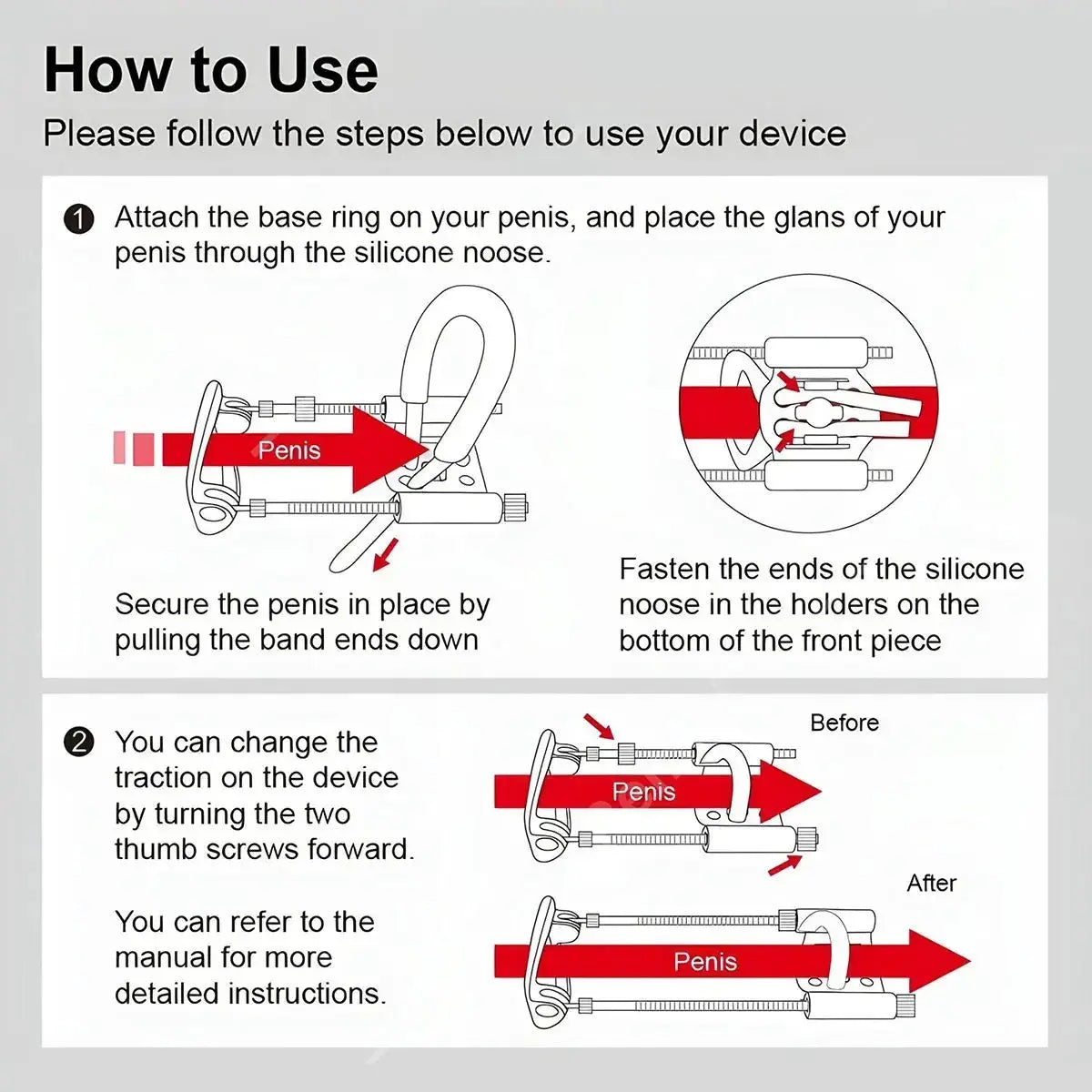 Adjustable Penis Extender Stretcher Kit - WOWihte